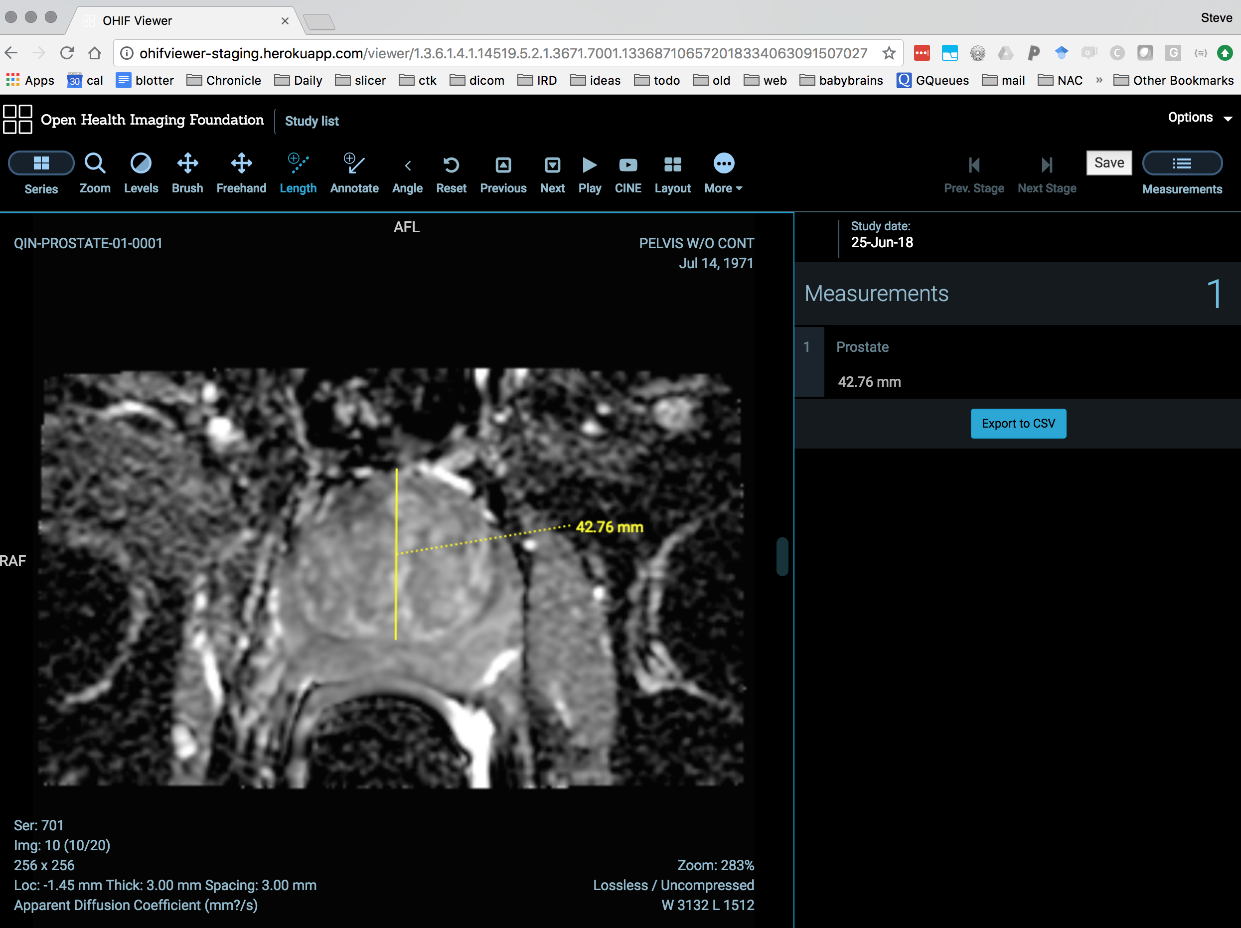 OHIFViewer can currently serialize/deserialize to DICOM SR for length measurements with unsecured dcm4chee back end.