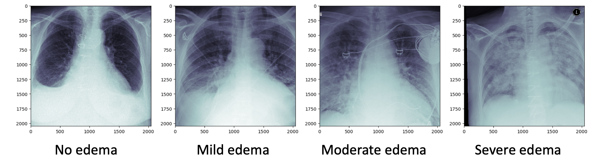 Example x-ray images: 