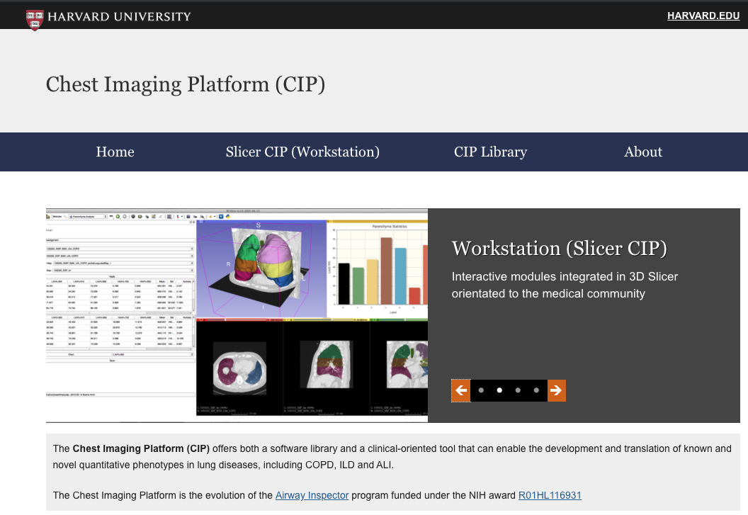Chest Imaging Platform website