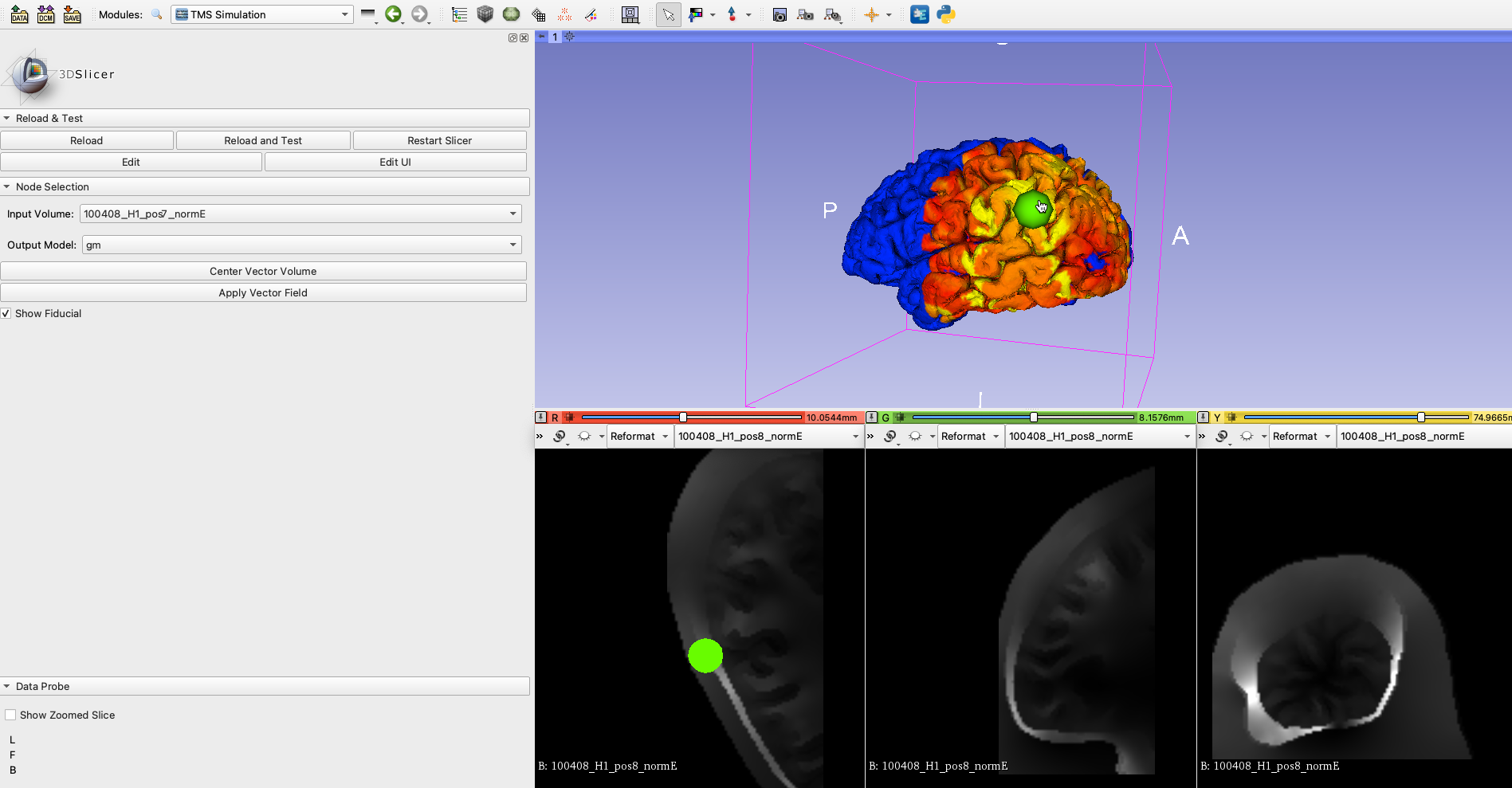 Slicer Module