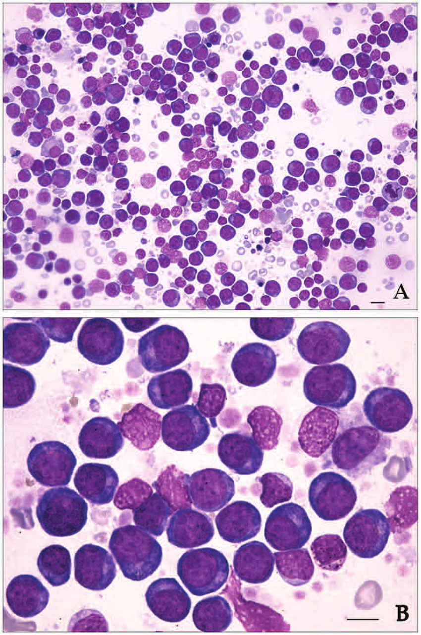 Example image of bone marrow smears